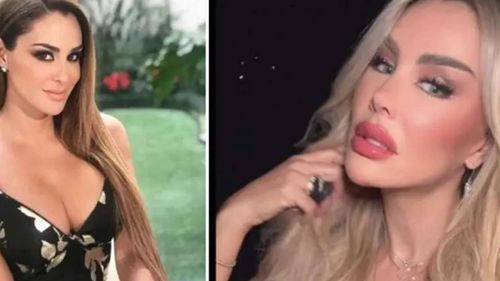  Ninel Conde Desata Controversia por Transformaciones Faciales a Causa de Cirugías