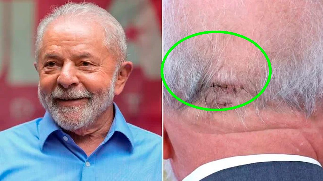 Qué le pasó a Lula Da Silva